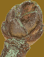 acer_pseudo_button